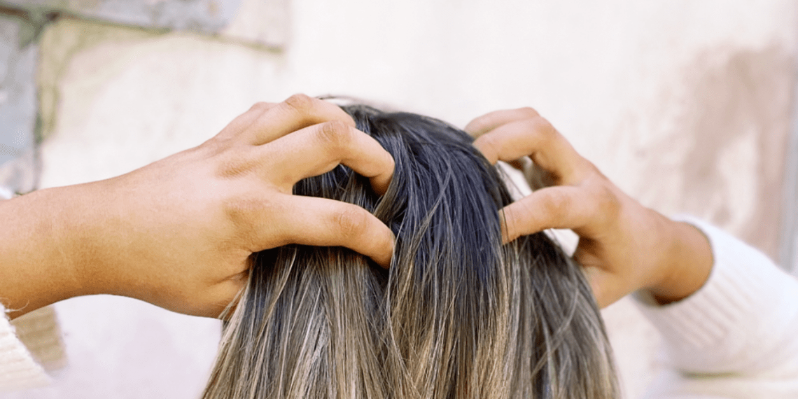 how to relieve itchy hair extensions