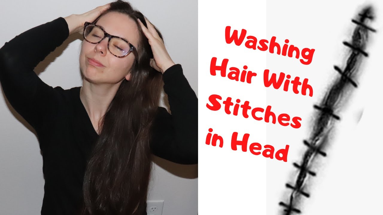 how to wash hair with scalp wound