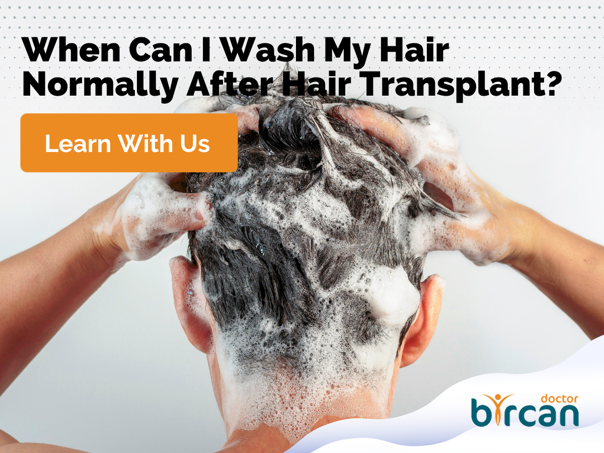When Can I Wash My Hair Normally After a Hair Transplant?